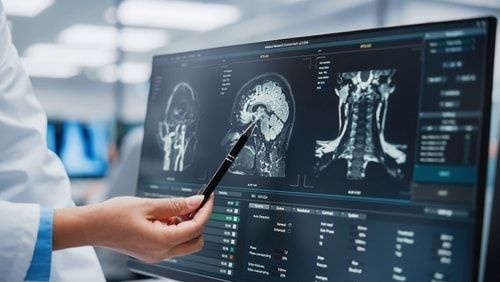 Medical Hospital: Neurologist and Neurosurgeon Talk, Use Computer, Analyse Patient MRI Scan, Diagnose Brain.